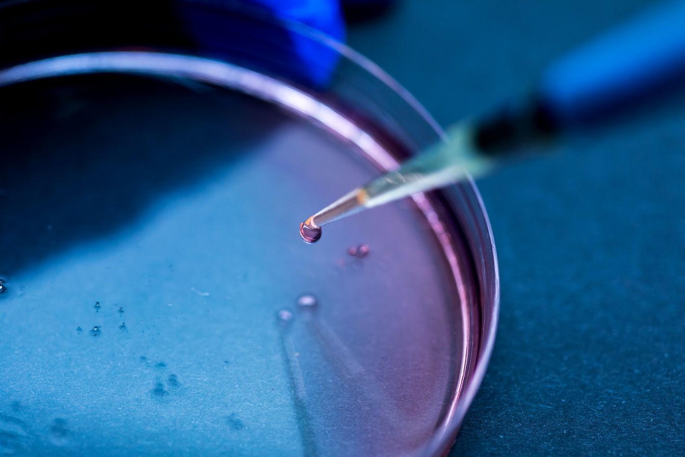 Сколько стоит донорская яйцеклетка