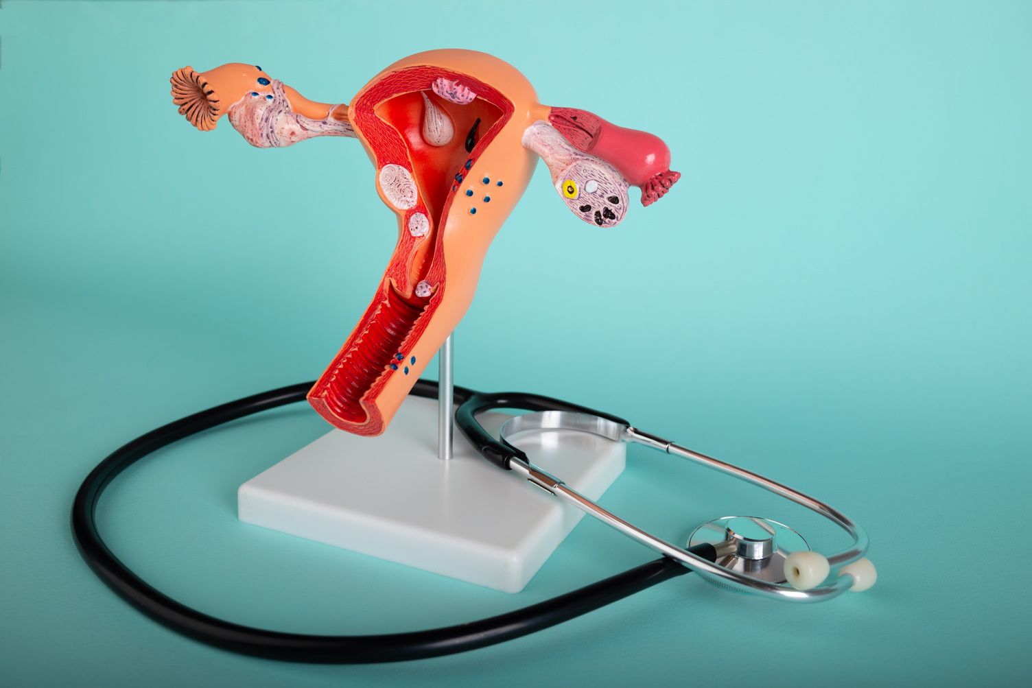 Почему не получается забеременеть