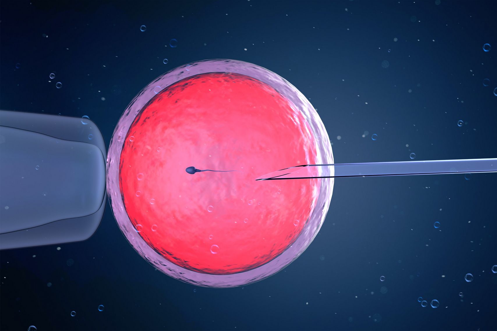 Плюсы и минусы ЭКО