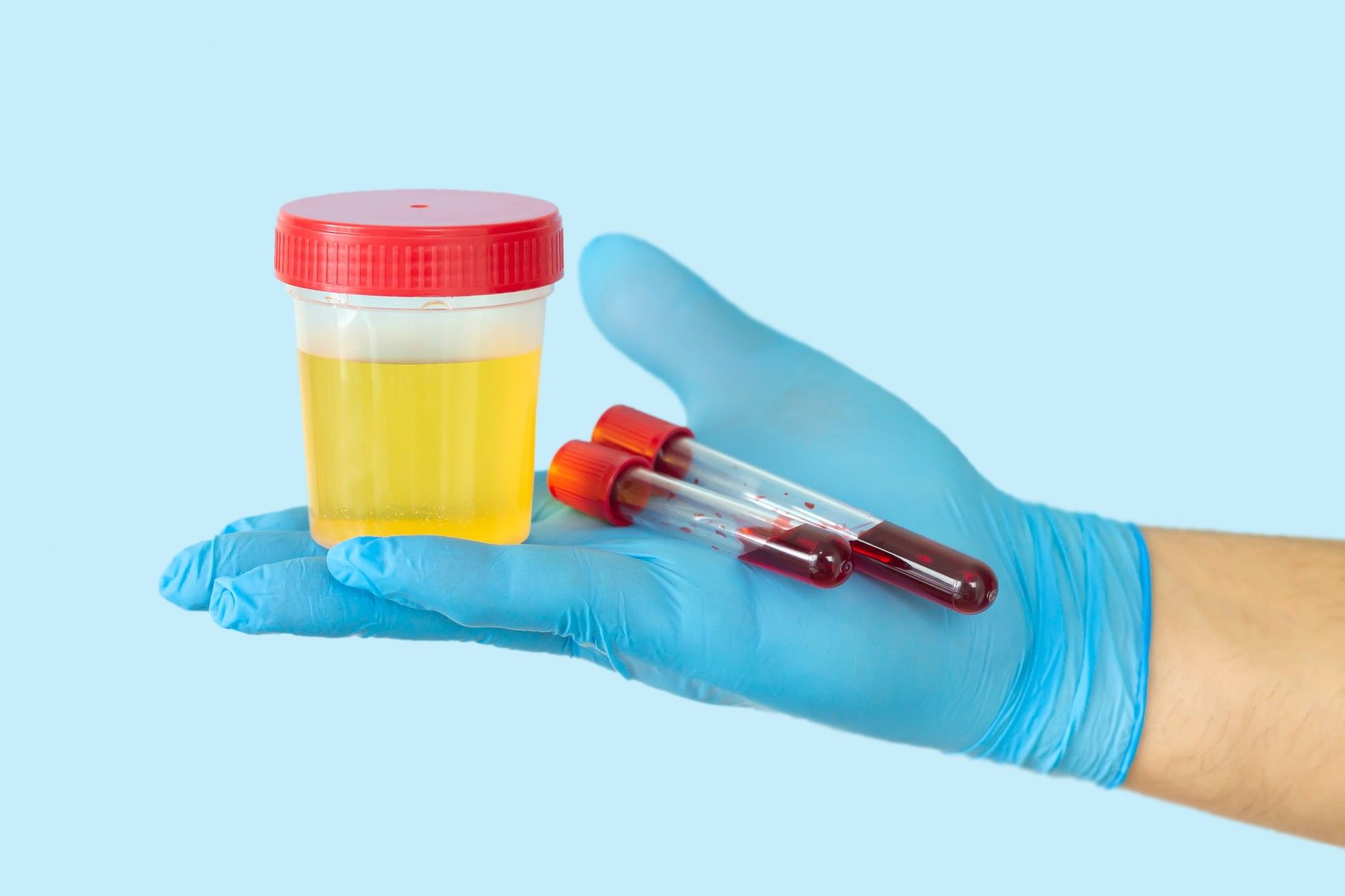 Анализы перед ЭКО