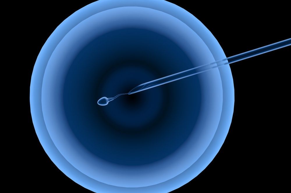 Метод ПИКСИ при ЭКО