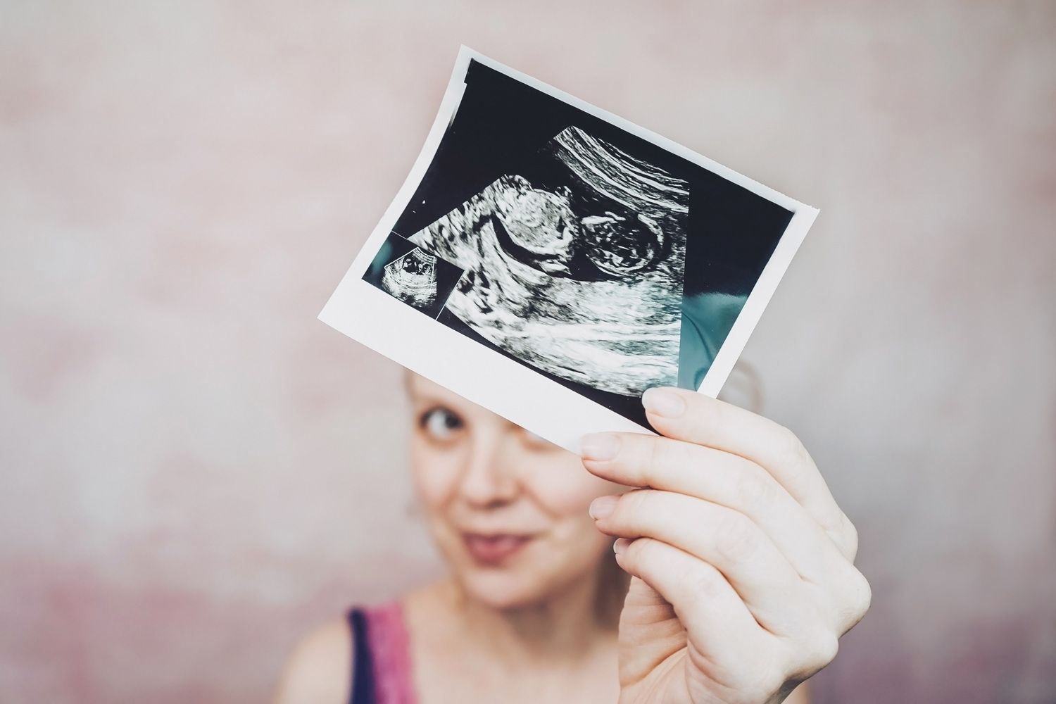 Плюсы и минусы ЭКО