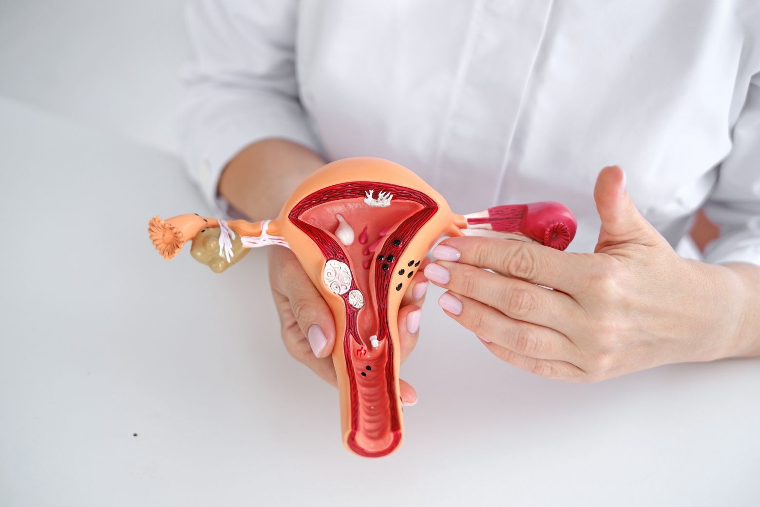 Можно ли забеременеть без маточных труб